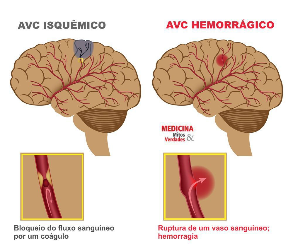 que significa cuando se apaga una veladora