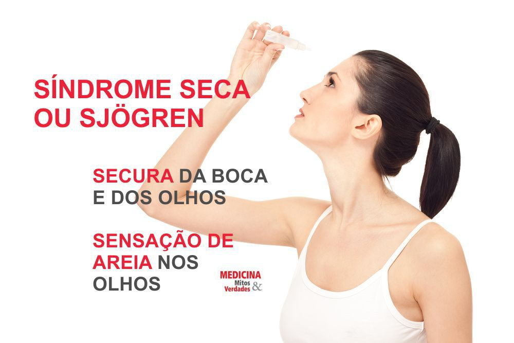 Síndrome seca ou síndrome Sjögren