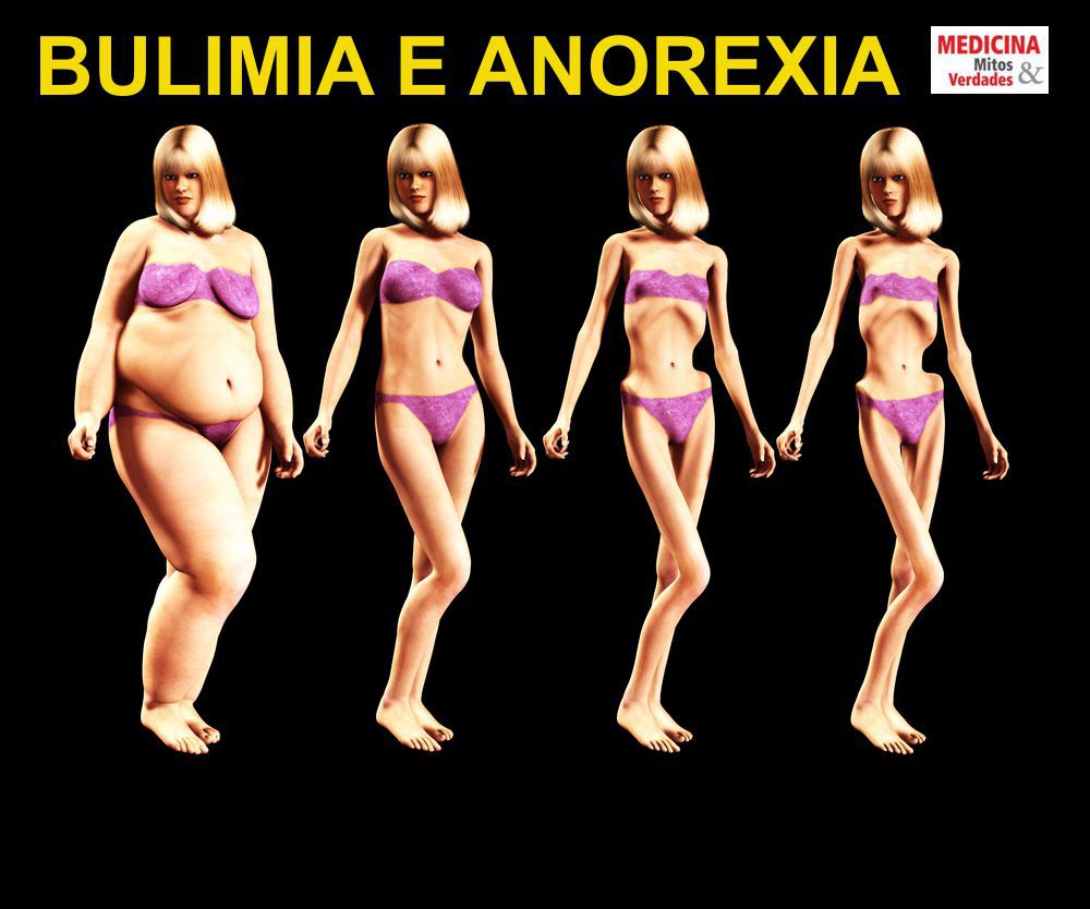 Bulimia e anorexia
