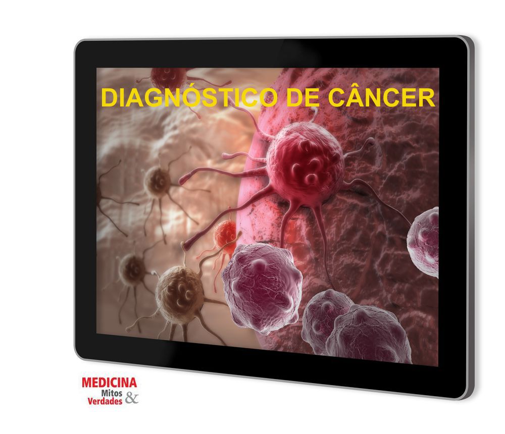 Avanços na medicina permite diagnóstico precoce do câncer