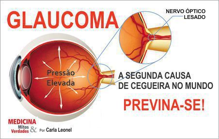 Previna-se contra o glaucoma