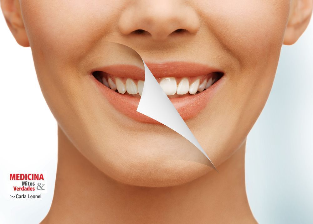Clareamento dental