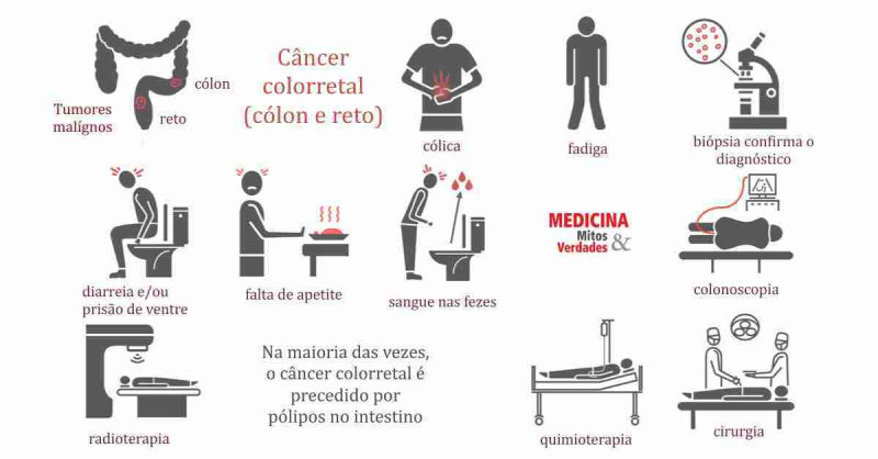 cancer de colon quais os sintomas)