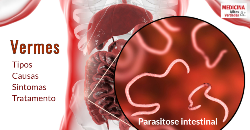 parazitozele intestinale