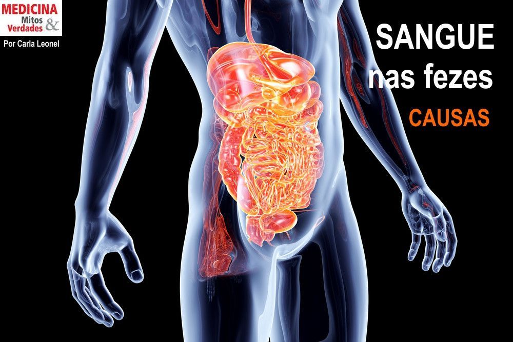 Sangue nas fezes é grave?