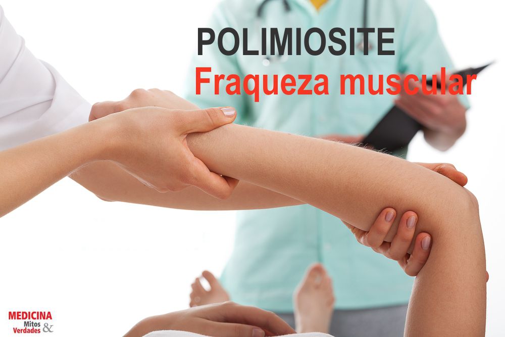 Fraqueza muscular é um dos sintomas de polimiosite