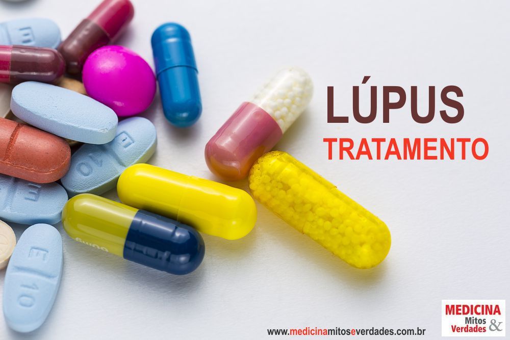 Tratamento Lúpus