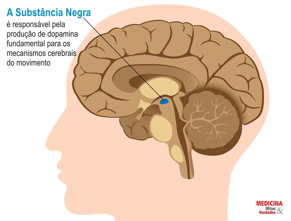 Tremores e Parkinson