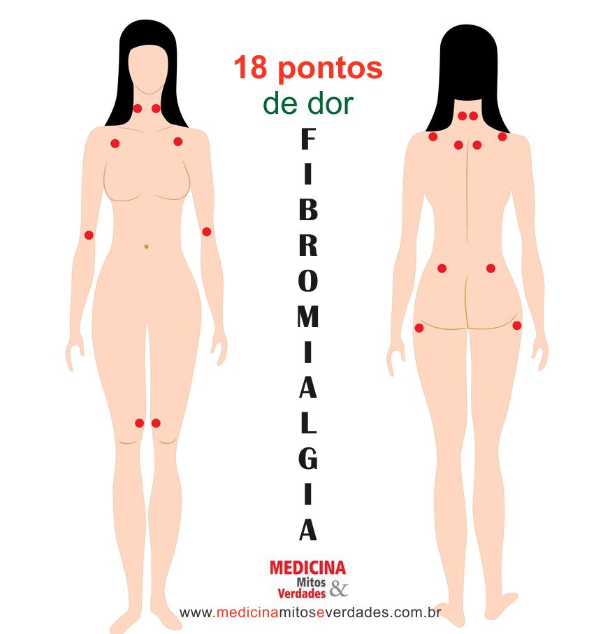 Doutor, sinto dor em tudo! Assim é a fibromialgia