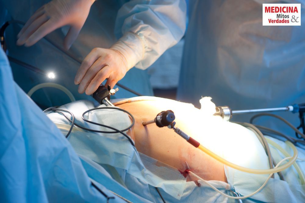 Cirurgia bariátrica, riscos e indicações