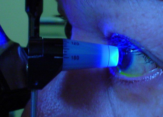Pressão intraocular alta