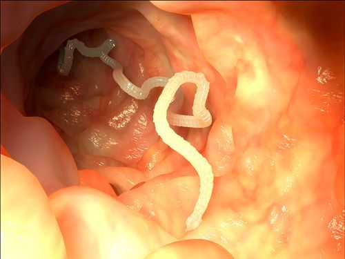 Vermes intestinais